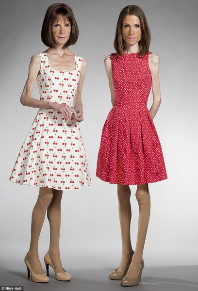 Anorexic Twins Disturbing Pact