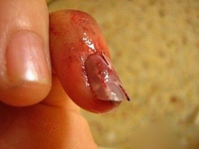 Are These Horrible Hand Wounds Real?