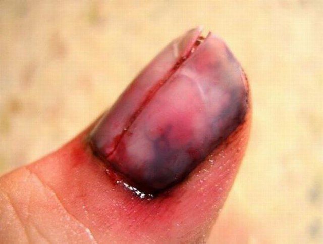 Are These Horrible Hand Wounds Real?