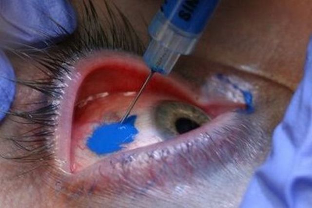 Creepy Eyeball Tattoos