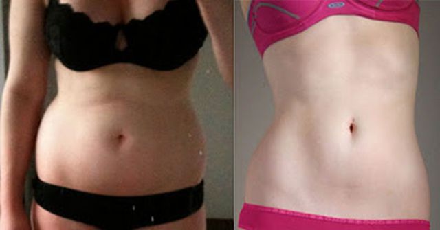 Once Chubby, Now Thin