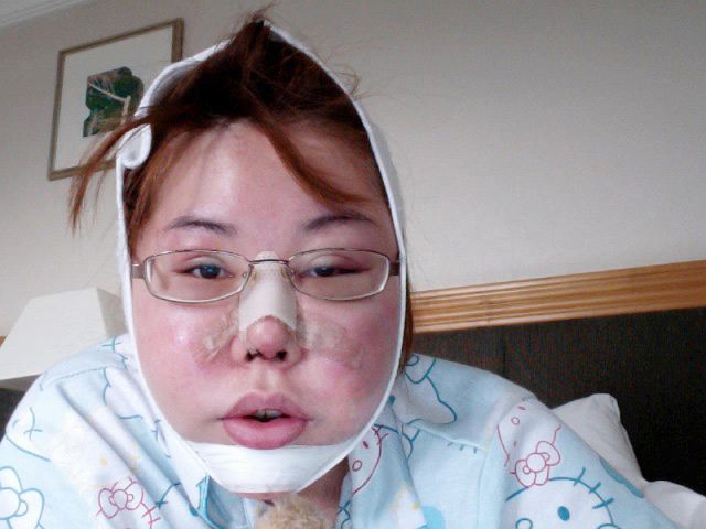 Woman Undergoes 10 Surgeries to Become Anime Character