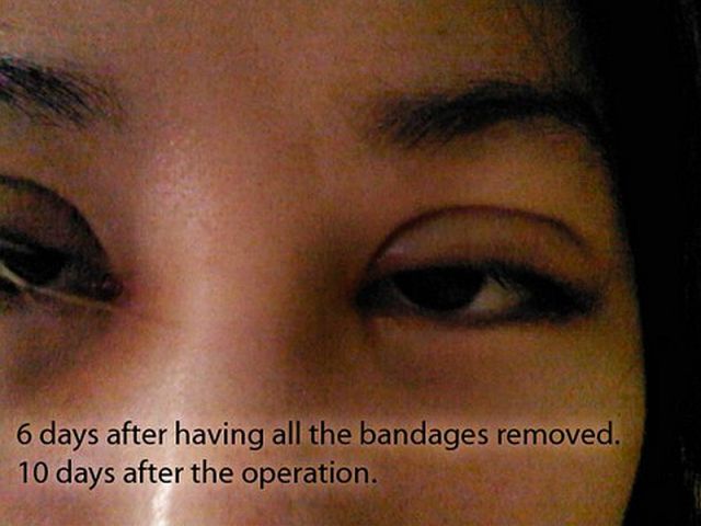 Woman Undergoes 10 Surgeries to Become Anime Character