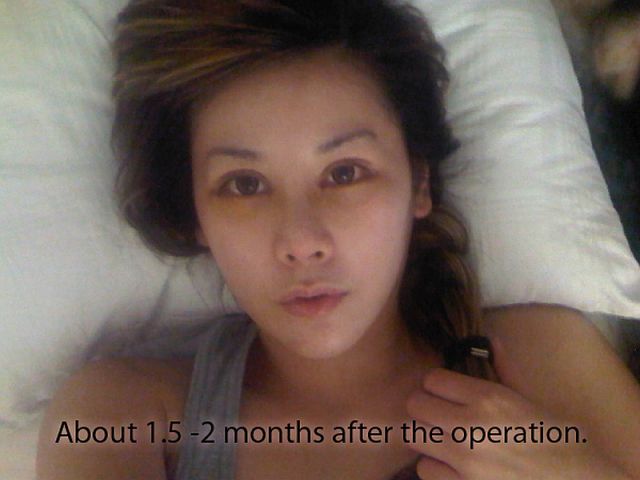 Woman Undergoes 10 Surgeries to Become Anime Character