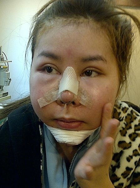 Woman Undergoes 10 Surgeries to Become Anime Character