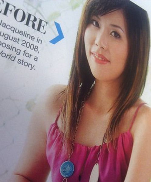 Woman Undergoes 10 Surgeries to Become Anime Character