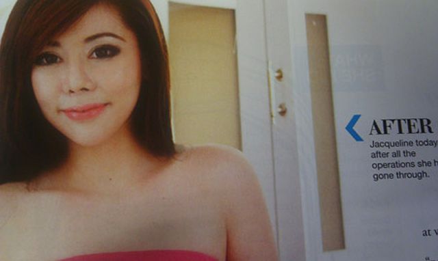 Woman Undergoes 10 Surgeries to Become Anime Character