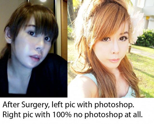 Woman Undergoes 10 Surgeries to Become Anime Character