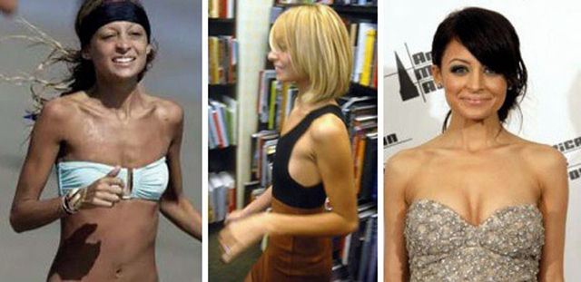 Celebs with the Worst Fake Breasts: Before and After