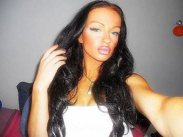 Ladies With Silicone Overdose