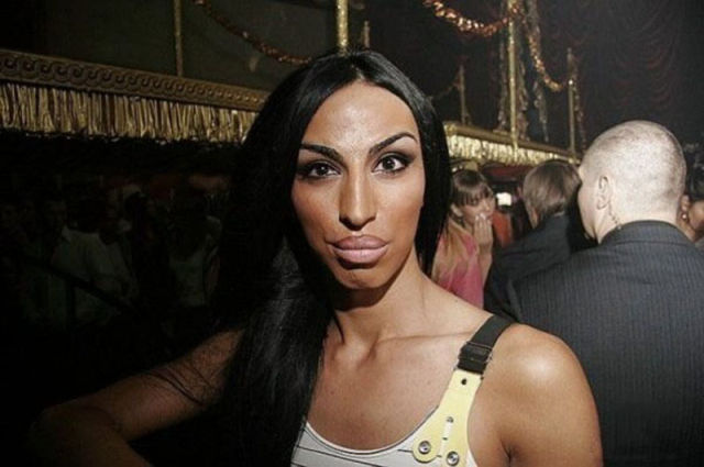 Ladies With Silicone Overdose