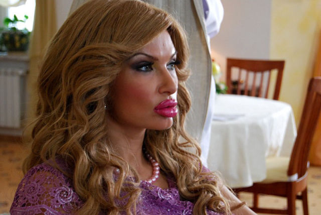 Ladies With Silicone Overdose