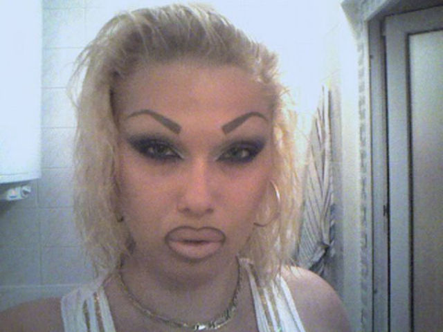 Ladies With Silicone Overdose