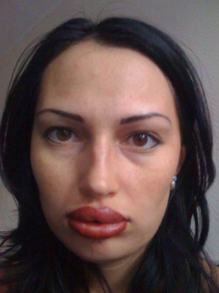 Ladies With Silicone Overdose