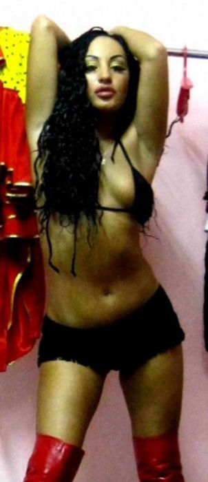 This Is What Excessive Plastic Surgery Looks Like