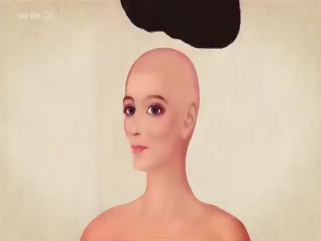 Supervenus: When Plastic Surgery Goes Beyond Horrible 