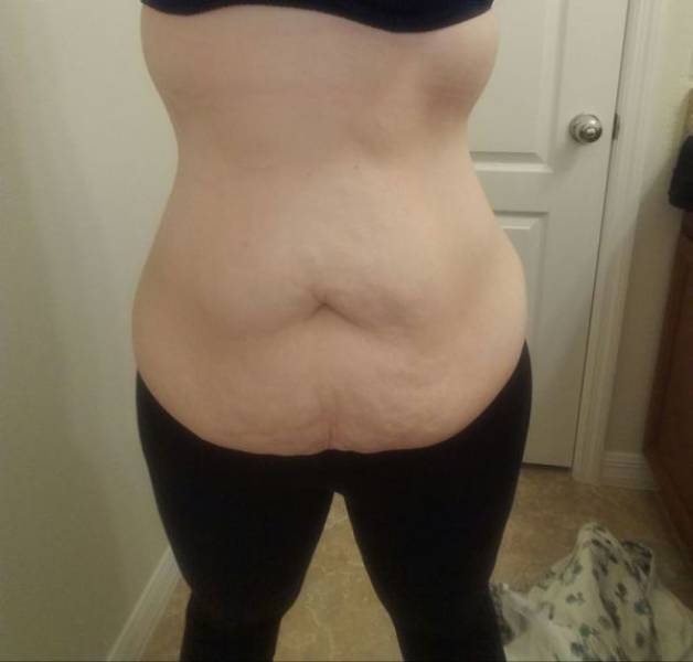 That’s How A Real Weight Loss Looks Like